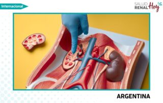 Argentina: Uno de cada ocho argentinos padecen enfermedad renal crónica y lo desconocen