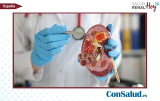 Con Salud: La OMS reconoce por primera vez la enfermedad renal crónica como prioridad global de salud pública