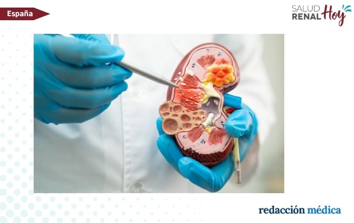 Redacción Médica: Garantía de sostenibilidad y calidad asistencial en ERC