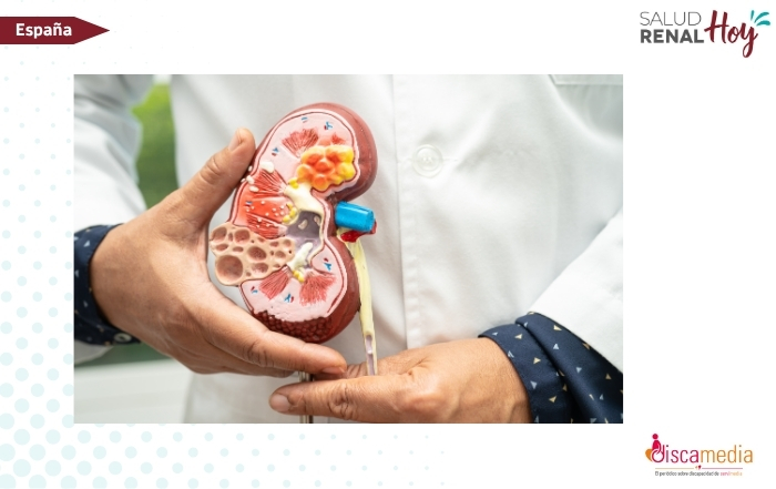 Servimedia: El protocolo 'Objetivo no diálisis' detecta la enfermedad renal oculta en el 14% de los pacientes de Burgos