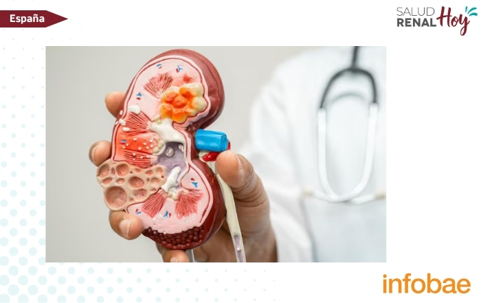 Infobae: El futuro del tratamiento de la enfermedad renal crónica