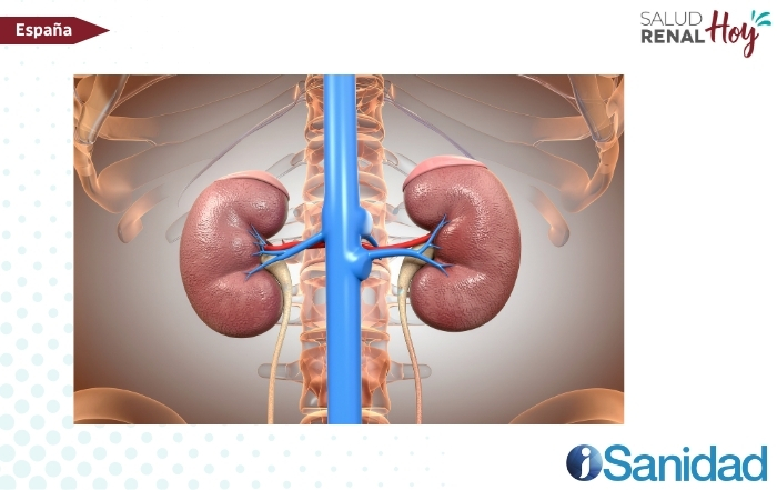 iSanidad: Albuminuria, indicador de diagnóstico de insuficiencia renal crónica