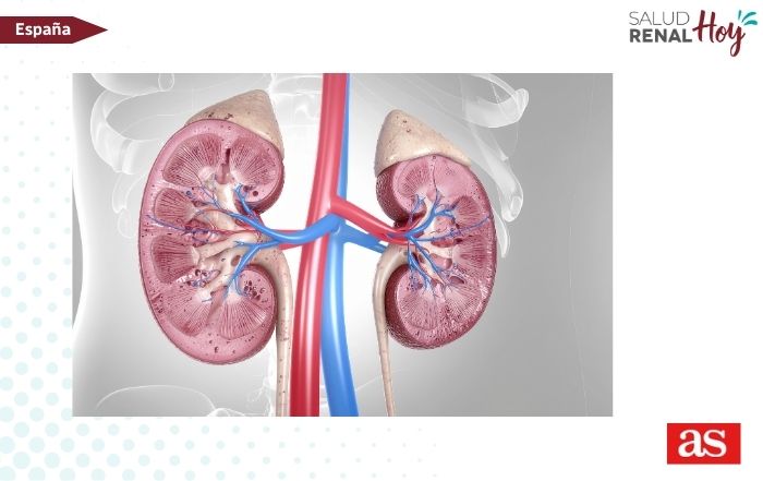 Diario AS: “Si bebemos menos de litro y medio de agua, el riñón se puede deshidratar y podemos sufrir mucho”