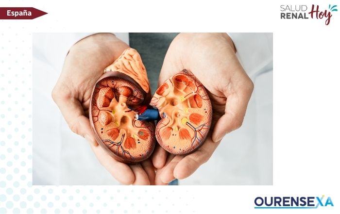 Ourense Xa: Buscamos mejorar la vida de los pacientes con enfermedad renal y de sus familiares