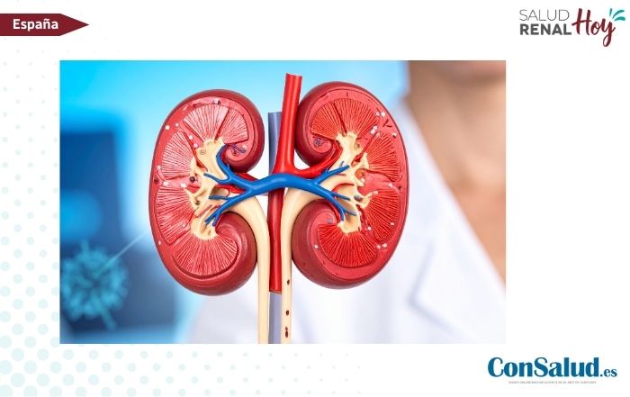 ConSalud.es: Componente bacteriano previamente desconocido en la formación de cálculos renales