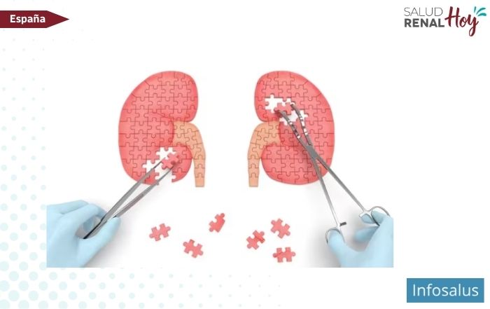 Infosalus: Incluida la enfermedad renal crónica en el acceso a la jubilación anticipada