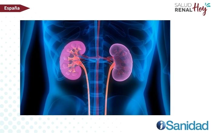 iSanidad: Detección precoz de la enfermedad renal crónica con una nueva calculadora