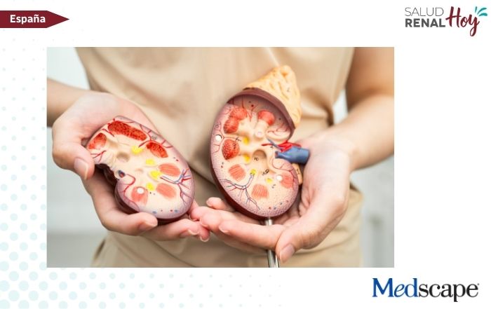 Medscape: Guías KDIGO 2026 para el manejo de la anemia en la enfermedad renal crónica