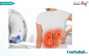 ConSalud.es: Una alimentación basada en verduras reduce el riesgo de enfermedad renal crónica