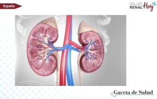 Gaceta de Salud: Primera terapia específica para la nefropatía membranosa primaria