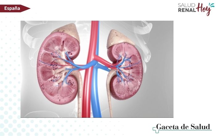 Gaceta de Salud: Primera terapia específica para la nefropatía membranosa primaria