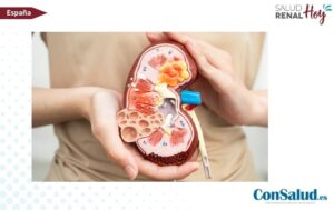 ConSalud.es: Transformación del abordaje de la Nefropatía por IgA