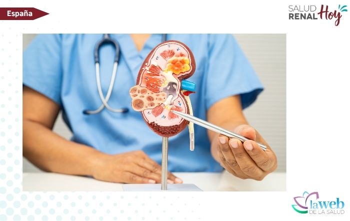 La Web de la Salud: Latinoamérica define su política de salud pública en Enfermedad Renal Crónica