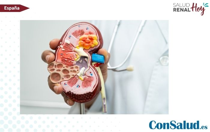 ConSalud.es: Una de cada diez personas que vive con enfermedad renal crónica no lo sabe