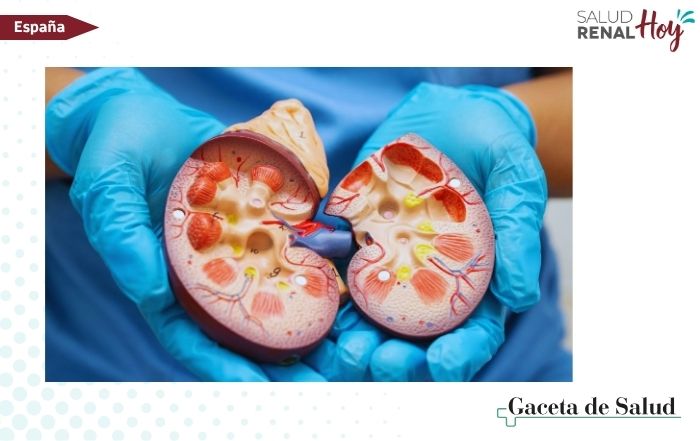 Gaceta de Salud: Adiós al daño en el riñón por obesidad
