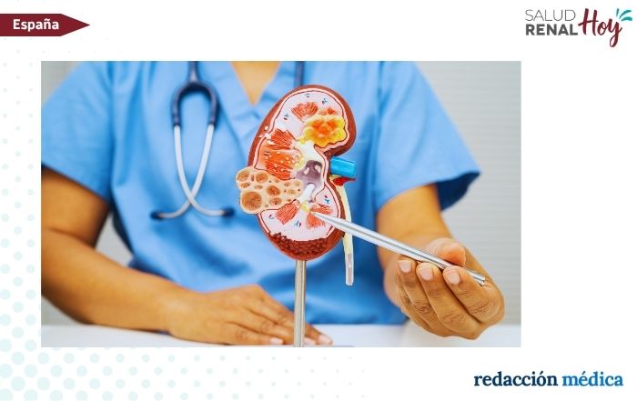 Redacción Médica: España financiará tres nuevos fármacos para el cáncer de mama, renal y asma