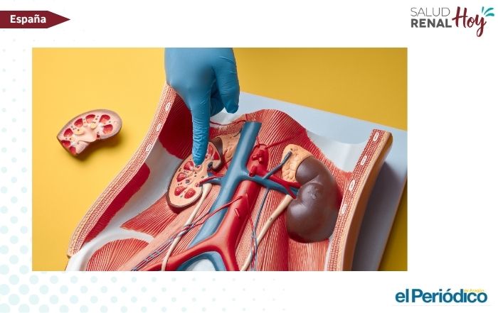El Periódico de Aragón: ¿Cómo se gestó el primer trasplante renal en Aragón?