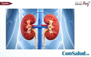 ConSalud.es: Experiencia pionera en denervación renal ConSalud.es: Experiencia pionera en denervación renal