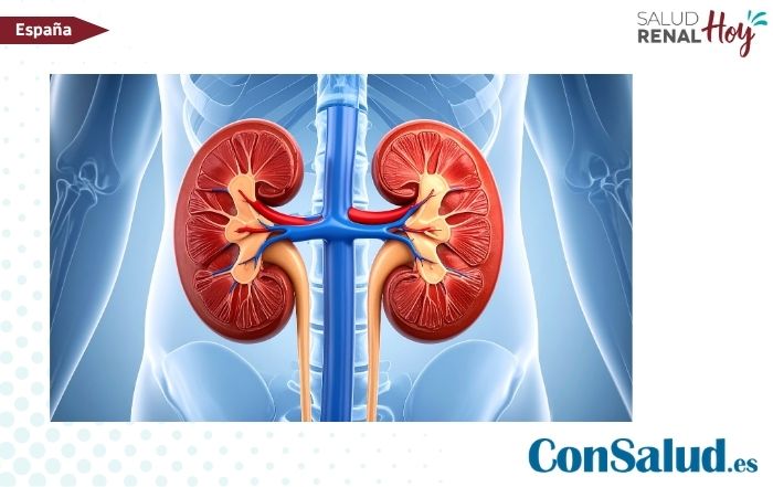 ConSalud.es: Experiencia pionera en denervación renal