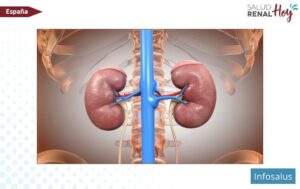 Infosalus: Fármaco dirigido contra la hipoxia tras la cirugía mejora su control en cáncer renal