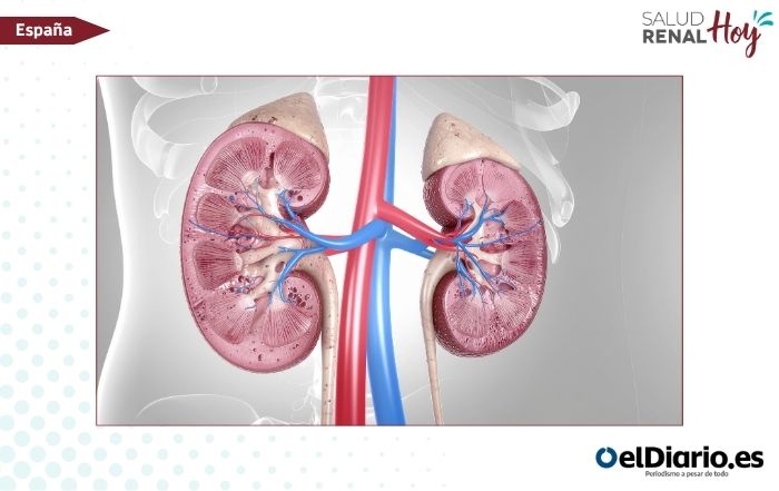 elDiario.es: Primer trasplante renal entre personas con VIH