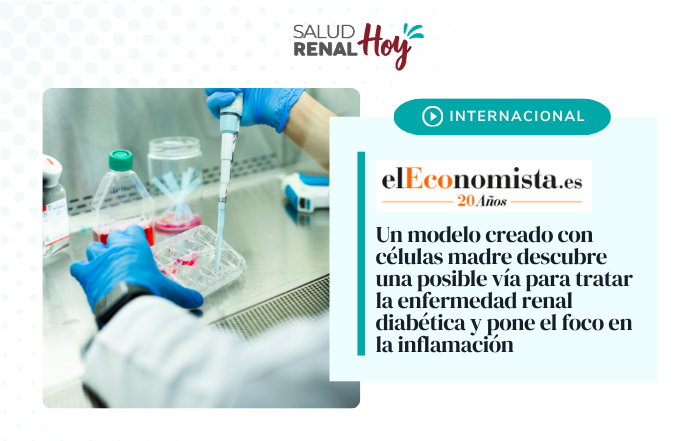 elEconomista.es: Un modelo creado con células madre descubre una posible vía para tratar la enfermedad renal diabética